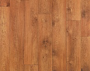 Sinteros Delta Kent 2